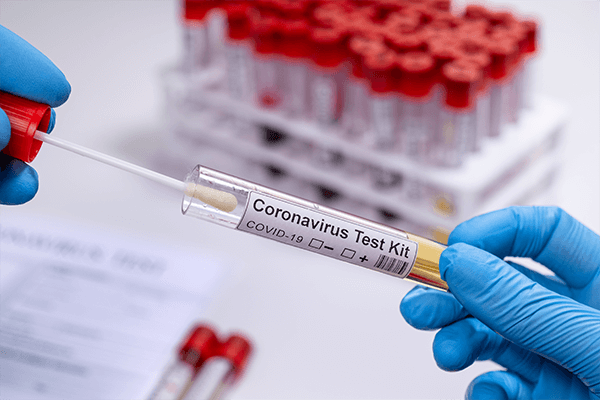 SARS-COV-2 test kit